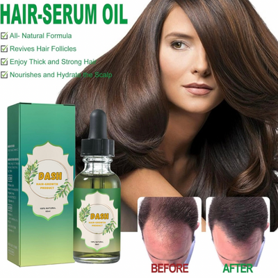 Dash Hair Growth Oil - Rosemary Oil Formula for Thicker, Healthier Hair